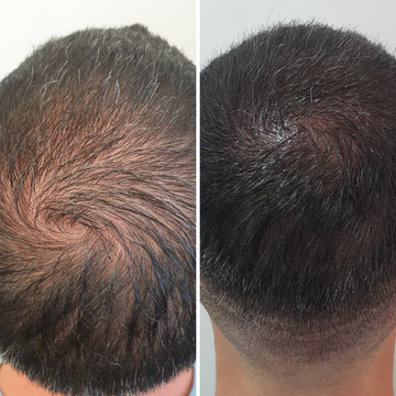 Real Before & After Stories with Dare Line
