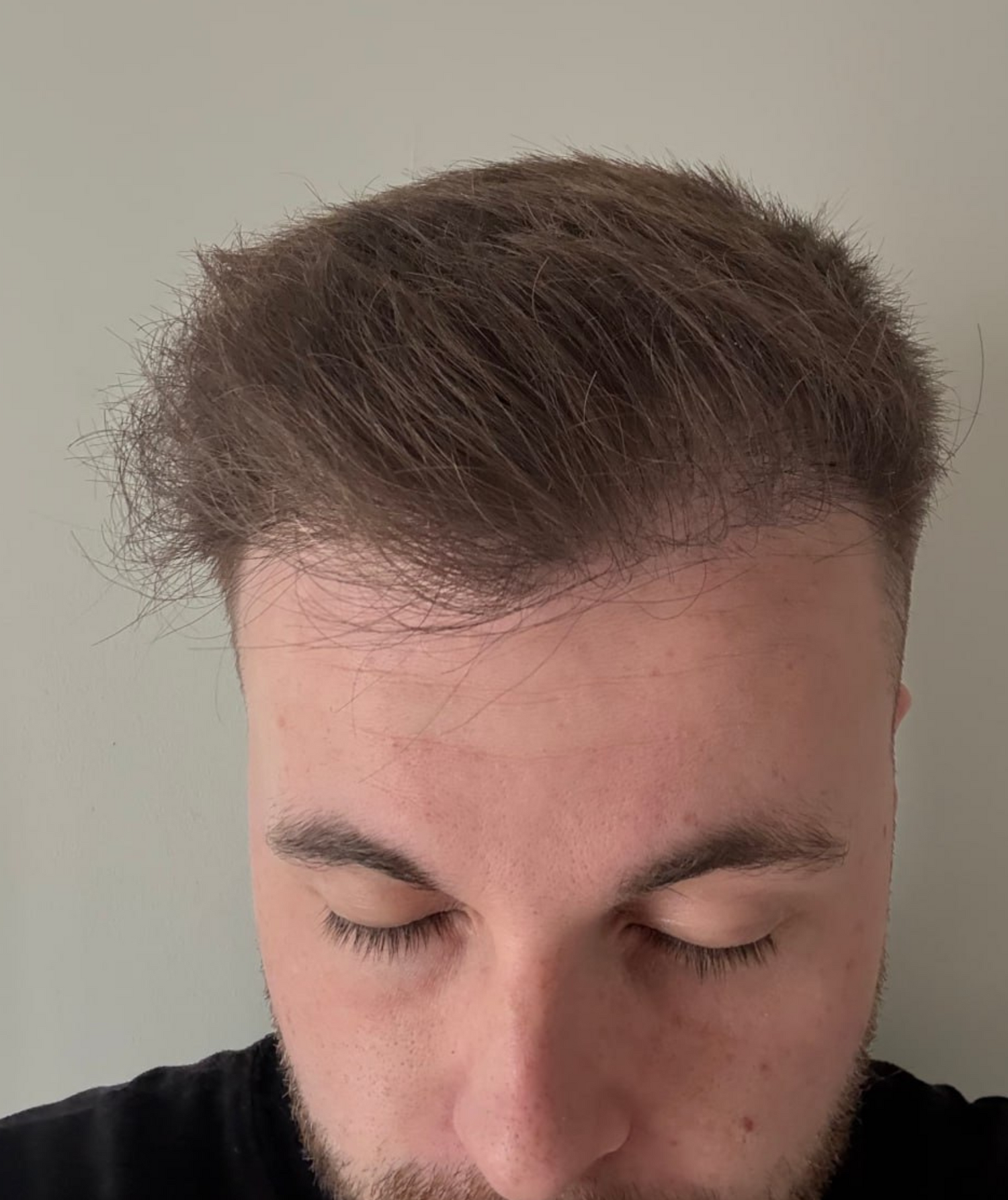 image comparison before