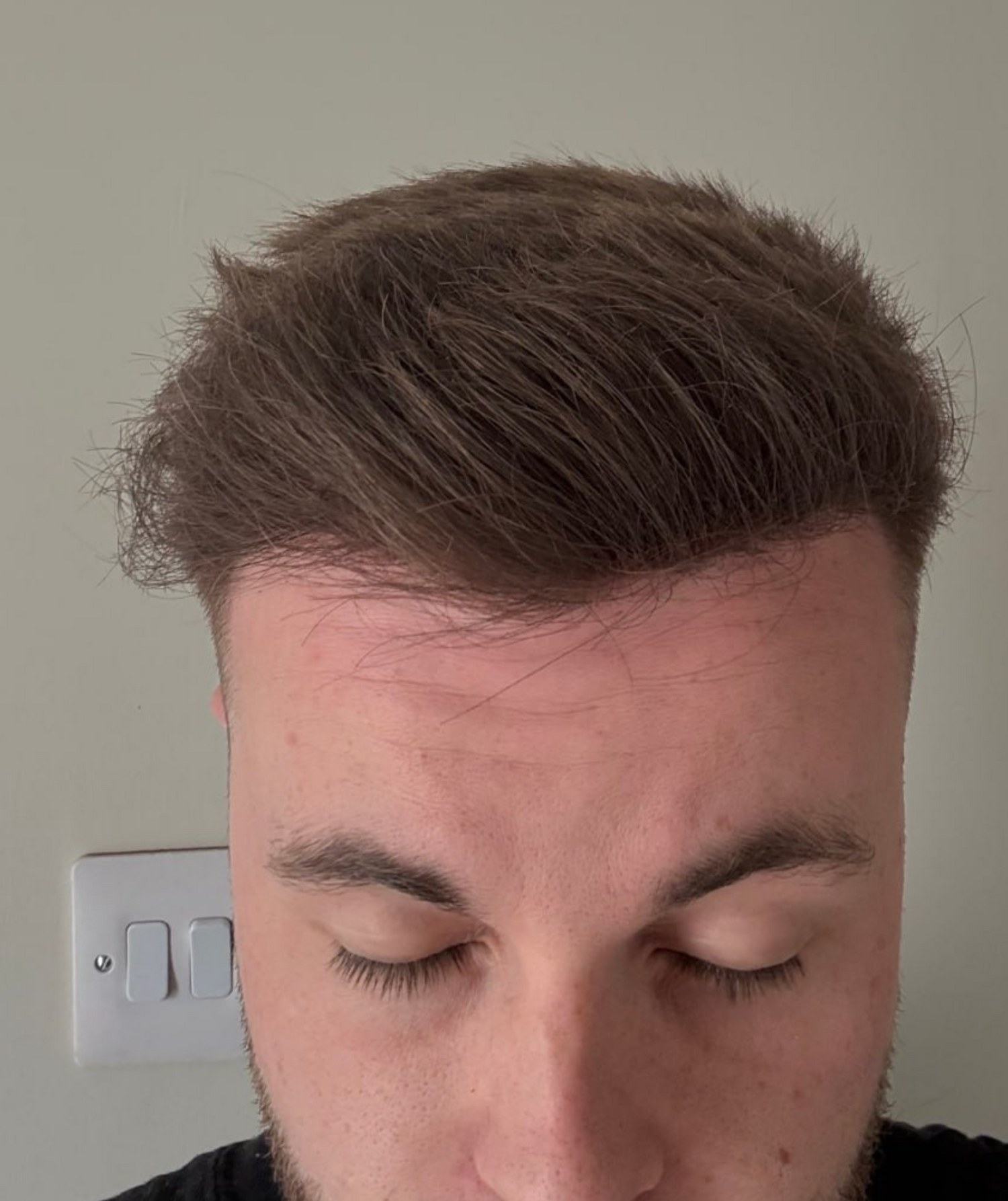 image comparison after