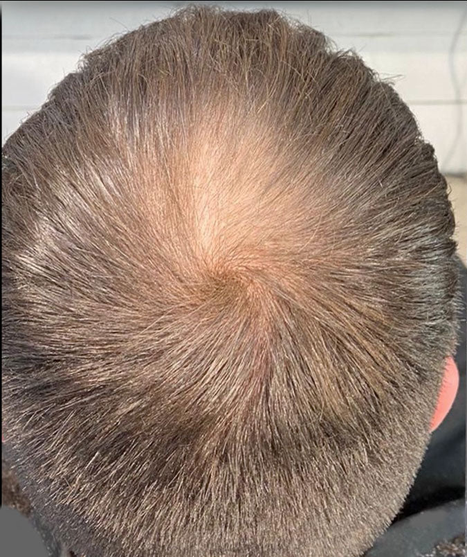 image comparison before